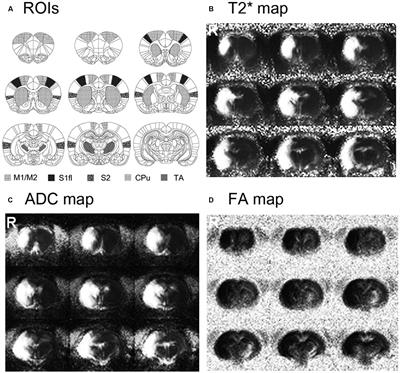 Enhanced Thalamic Functional Connectivity with No fMRI Responses to Affected Forelimb Stimulation in Stroke-Recovered Rats